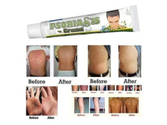 Мазь от псориаза Psoriasis cream, 20 гр