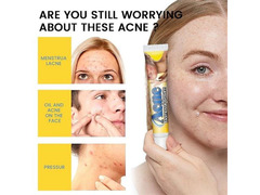 Мазь от прыщей Sumifun Acne Removal Cream, 30гр