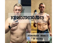  Криолиполиз для мужчин, похудение без операции