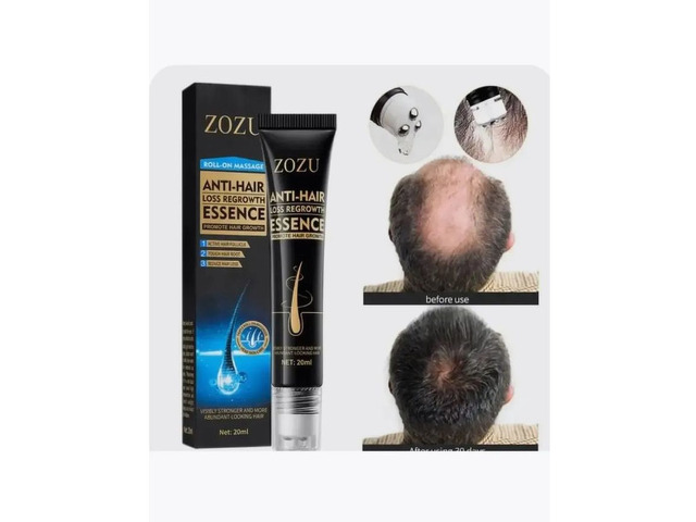 Сыворотка для укрепления и роста волос Zozu Anti-H - 4/8
