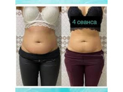 Женский мастер массажа / 5