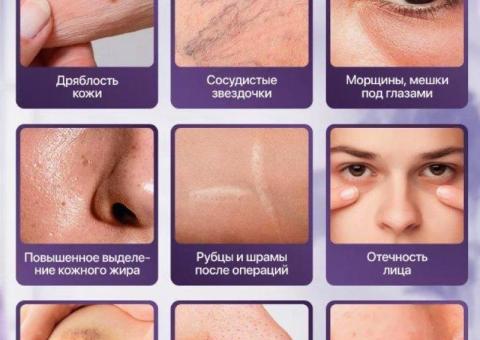 Дарсонваль Дерма Ванд (Derma Wand) / 6