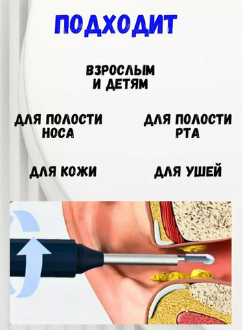 Ушная палочка умная для чистки ушей с камерой HD - 3/4