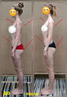 Остеопластика. Диафрагмальные практики