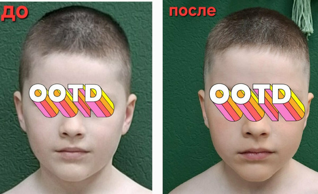 Остеопластика. Диафрагмальные практики - 3/11