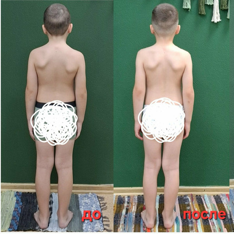 Остеопластика. Диафрагмальные практики - 5/11