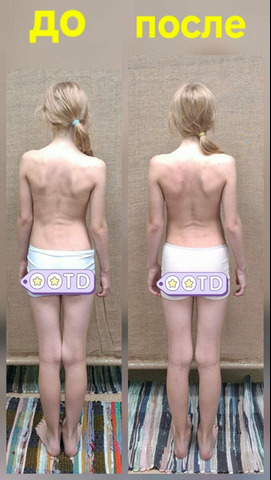 Остеопластика. Диафрагмальные практики - 6/11