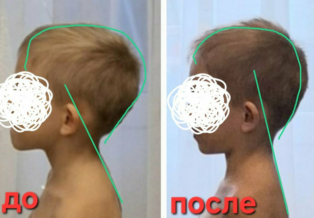 Остеопластика. Диафрагмальные практики - 7/11