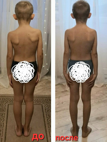 Остеопластика. Диафрагмальные практики - 8/11