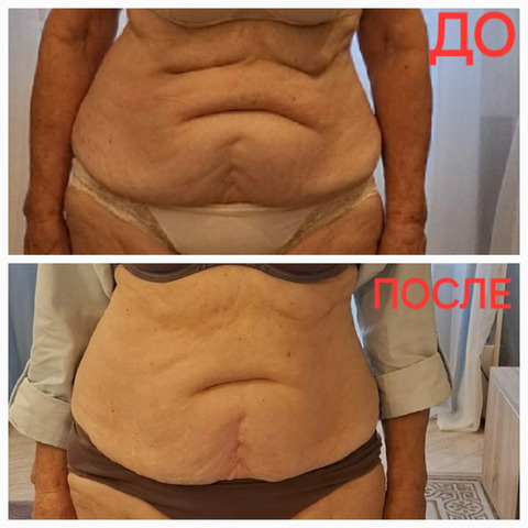 Остеопластика. Диафрагмальные практики - 9/11