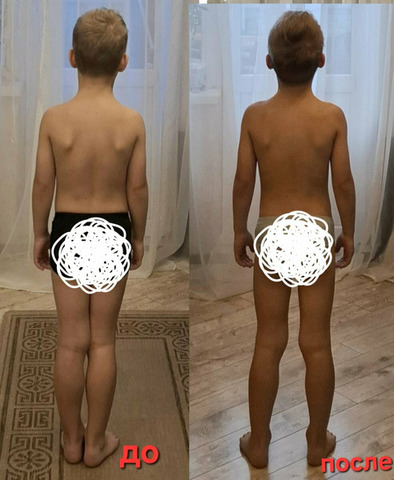 Остеопластика. Диафрагмальные практики - 10/11